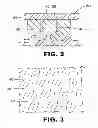 Fig. 03 - SIPE GEOMETRY FOR IMPROVED BUFFING OF TREAD BAND