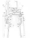 Fig. 01 - Bicycle brake arm