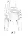 Fig. 02 - Bicycle brake arm