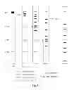 Fig. 07 - METHODS, CASSETTES, GELS AND APPARATUSES FOR ISOLATION AND COLLECTION OF BIOMOLECULES FROM ELECTROPHORESIS GELS