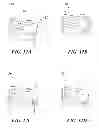 Fig. 17 - Biosafety cabinet filter removal devices, systems, and methods