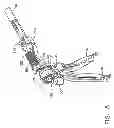 Fig. 09 - SURGICAL INSTRUMENT