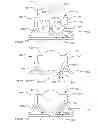 Fig. 09 - Optical lens securing assembly for an illumination device