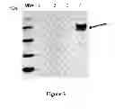 Fig. 04 - Colon and Rectal Tumor Markers and Methods of Use Thereof