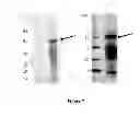 Fig. 08 - Colon and Rectal Tumor Markers and Methods of Use Thereof