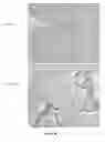 Fig. 32 - Colon and Rectal Tumor Markers and Methods of Use Thereof