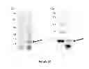 Fig. 33 - Colon and Rectal Tumor Markers and Methods of Use Thereof