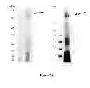 Fig. 35 - Colon and Rectal Tumor Markers and Methods of Use Thereof