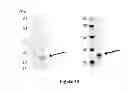 Fig. 41 - Colon and Rectal Tumor Markers and Methods of Use Thereof