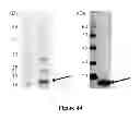 Fig. 45 - Colon and Rectal Tumor Markers and Methods of Use Thereof