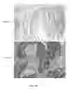 Fig. 46 - Colon and Rectal Tumor Markers and Methods of Use Thereof