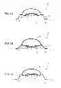 Fig. 02 - Force regulating device applicators