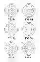 Fig. 07 - BULLSEYE DISPLAY FOR ECG DATA