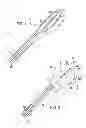 Fig. 02 - Apparatus and method for destruction of vascular thrombus