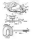 Fig. 02 - Peripheral Pain-Relief Device that is Non-Invasive and Non-Pharmaceutical