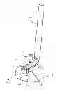 Fig. 01 - Corneal implant retaining devices and methods of use
