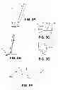 Fig. 04 - Corneal implant retaining devices and methods of use