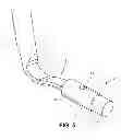 Fig. 06 - Corneal implant retaining devices and methods of use