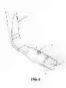 Fig. 07 - Corneal implant retaining devices and methods of use