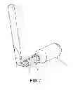 Fig. 08 - Corneal implant retaining devices and methods of use