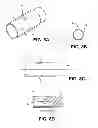 Fig. 09 - Corneal implant retaining devices and methods of use