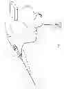 Fig. 02 - Devices and Methods for Endovascular Therapies