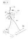 Fig. 04 - Suturing method