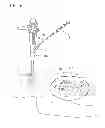 Fig. 07 - Suturing method