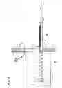Fig. 13 - Suturing method