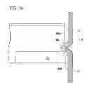 Fig. 17 - Suturing method