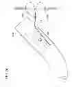 Fig. 27 - Suturing method