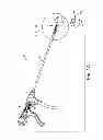 Fig. 02 - Suture system with capsule eyelet providing multiple suture tissue fixation
