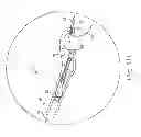 Fig. 03 - Suture system with capsule eyelet providing multiple suture tissue fixation