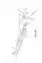 Fig. 08 - Suture system with capsule eyelet providing multiple suture tissue fixation