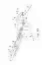Fig. 16 - Suture system with capsule eyelet providing multiple suture tissue fixation