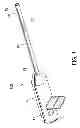 Fig. 02 - Suture tensioning device