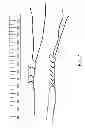 Fig. 07 - Suture tensioning device