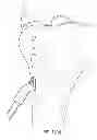 Fig. 20 - Suture tensioning device