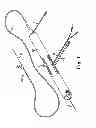 Fig. 02 - Rotational atherectomy device with electric motor