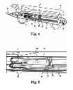 Fig. 07 - Rotational atherectomy device with electric motor