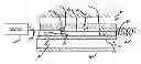 Fig. 01 - Apparatus and method for deployment of a therapeutic device using a catheter