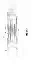 Fig. 09 - Articulating surgical apparatus