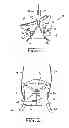 Fig. 02 - SPINAL TRACTION DEVICE