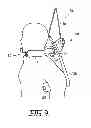 Fig. 09 - SPINAL TRACTION DEVICE