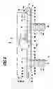 Fig. 06 - Implant for mutually supporting the spinous processes of adjacent vertebral bodies and a surgical system