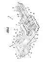 Fig. 07 - Implant for mutually supporting the spinous processes of adjacent vertebral bodies and a surgical system