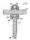 Fig. 01 - Uniplanar screw