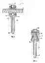 Fig. 02 - Uniplanar screw