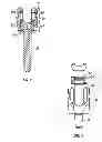 Fig. 03 - Uniplanar screw