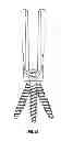 Fig. 07 - Uniplanar screw